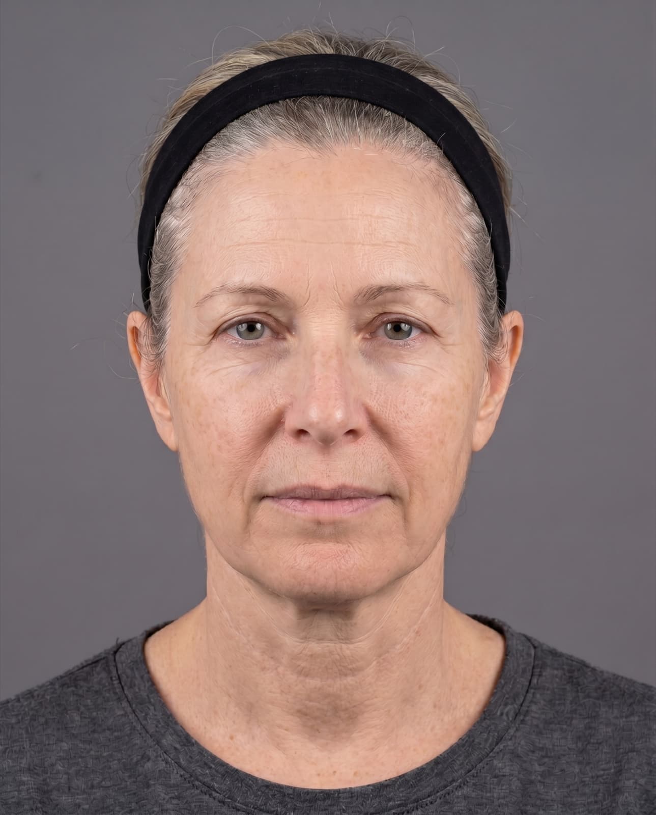 Anti-aging