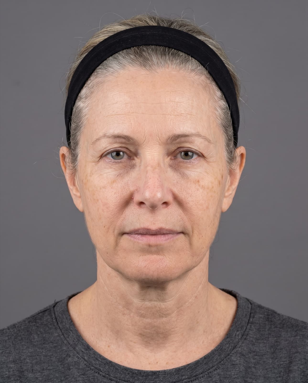 Anti-aging